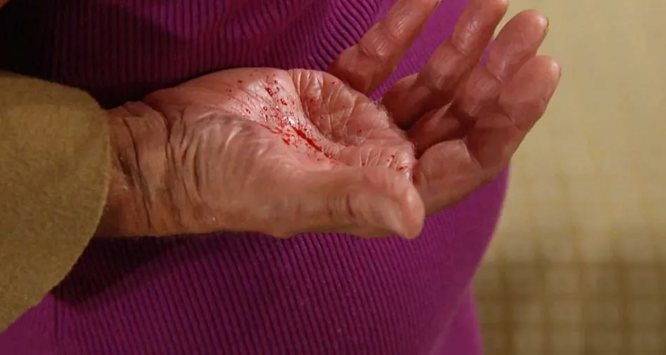 Eric découvre du sang dans sa main après avoir toussé...